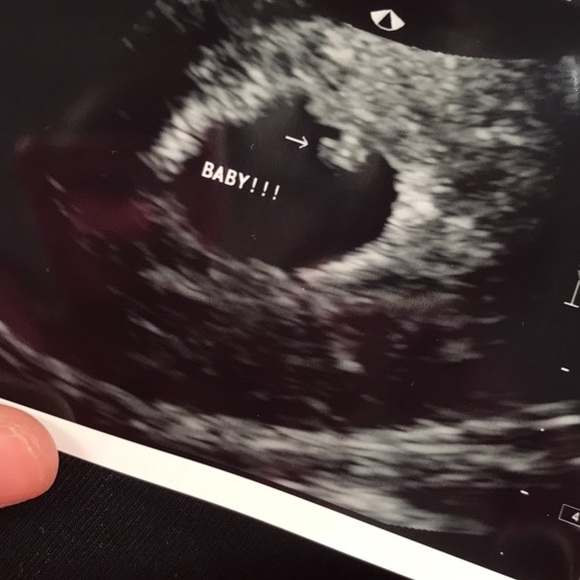 Meet your Posher, Keaylee - Picture 4 of 8